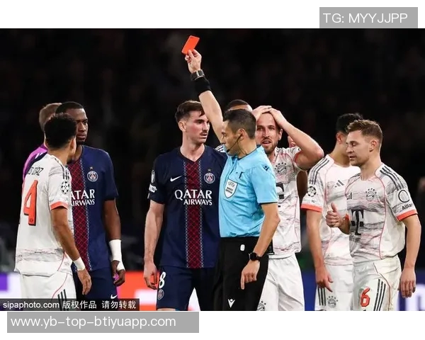 巴黎官方确认杜埃右大腿肌肉受伤预计缺阵数周影响球队阵容 巴黎官方确认杜埃右大腿肌肉受伤预计缺阵数周影响球队阵容